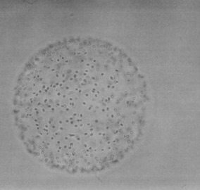 light microscopic photo of Phaeocystis globosa